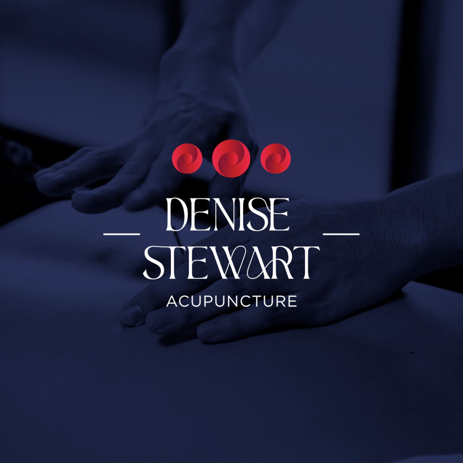Denise Stewart Acupuncture